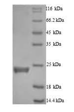 Human CASP5 / Caspase 5 Protein (Recombinant 6His, N-terminus)