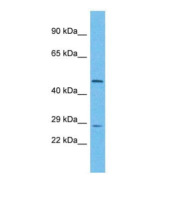 UTP11L Antibody (N-Terminus)