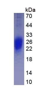Rabbit IFN Gamma / Interferon Gamma Protein (Recombinant His, N-Terminal)