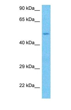 SPAM1 / PH20 Antibody (Internal)