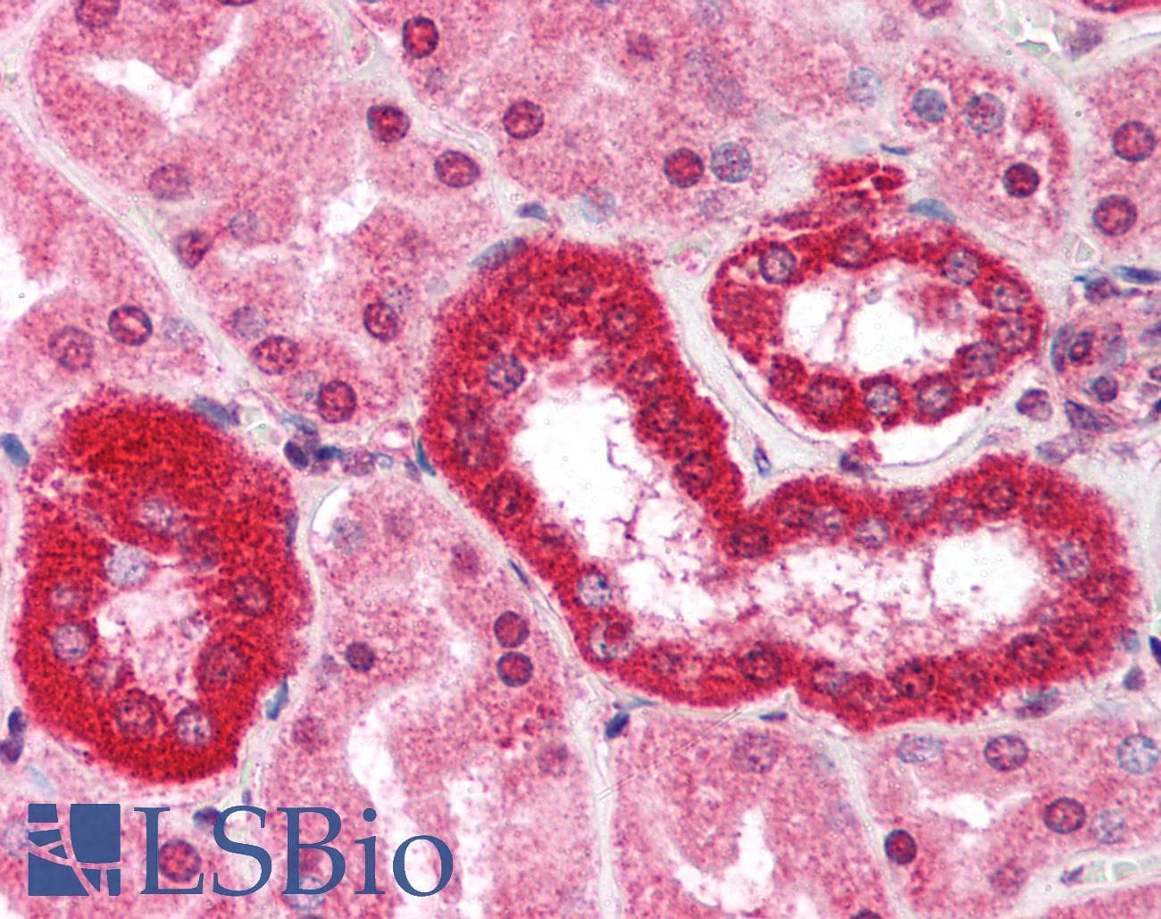 IHC-plus™ Monoclonal Mouse anti-Human RAD52 Antibody (clone 5H9, IHC, WB)