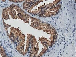 ACAT2 Antibody (clone OTI7B1)