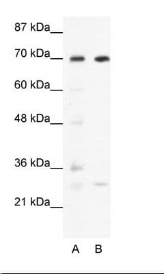 Polyclonal Rabbit anti-Human WRNIP1 / WHIP Antibody (aa67-116, IHC, WB)
