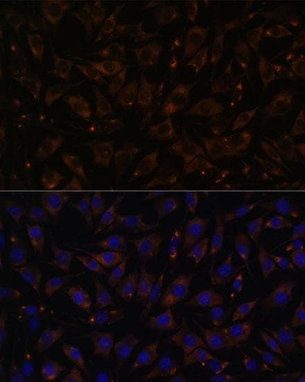 Polyclonal Rabbit anti-Human PLLP / Plasmolipin Antibody (IF)