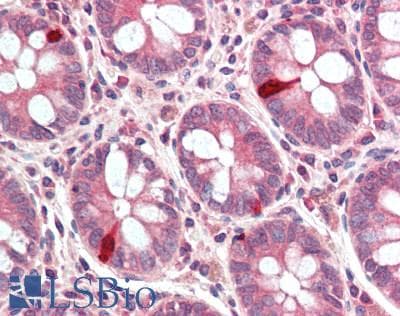 IHC-plus™ SMG6 Antibody