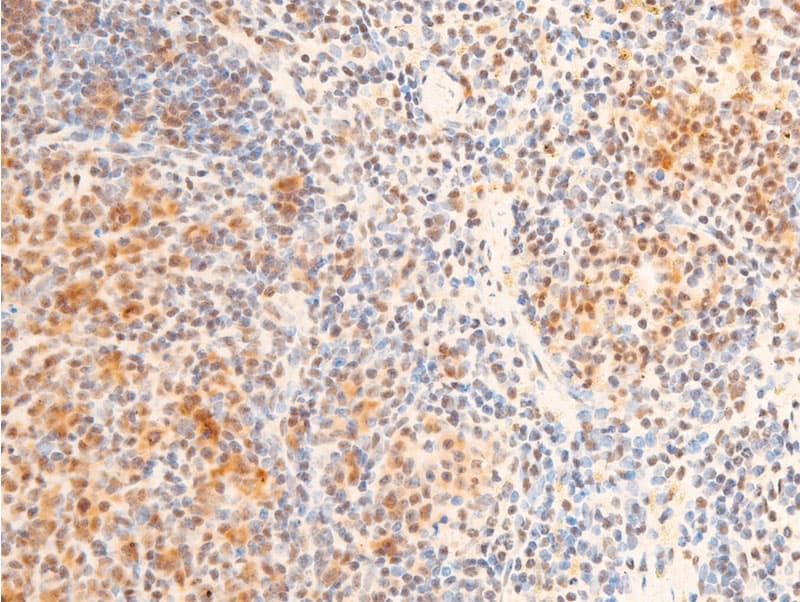Polyclonal Rabbit anti-Human FOXO3 / FOXO3A Antibody (phospho-Ser253, IHC, WB)