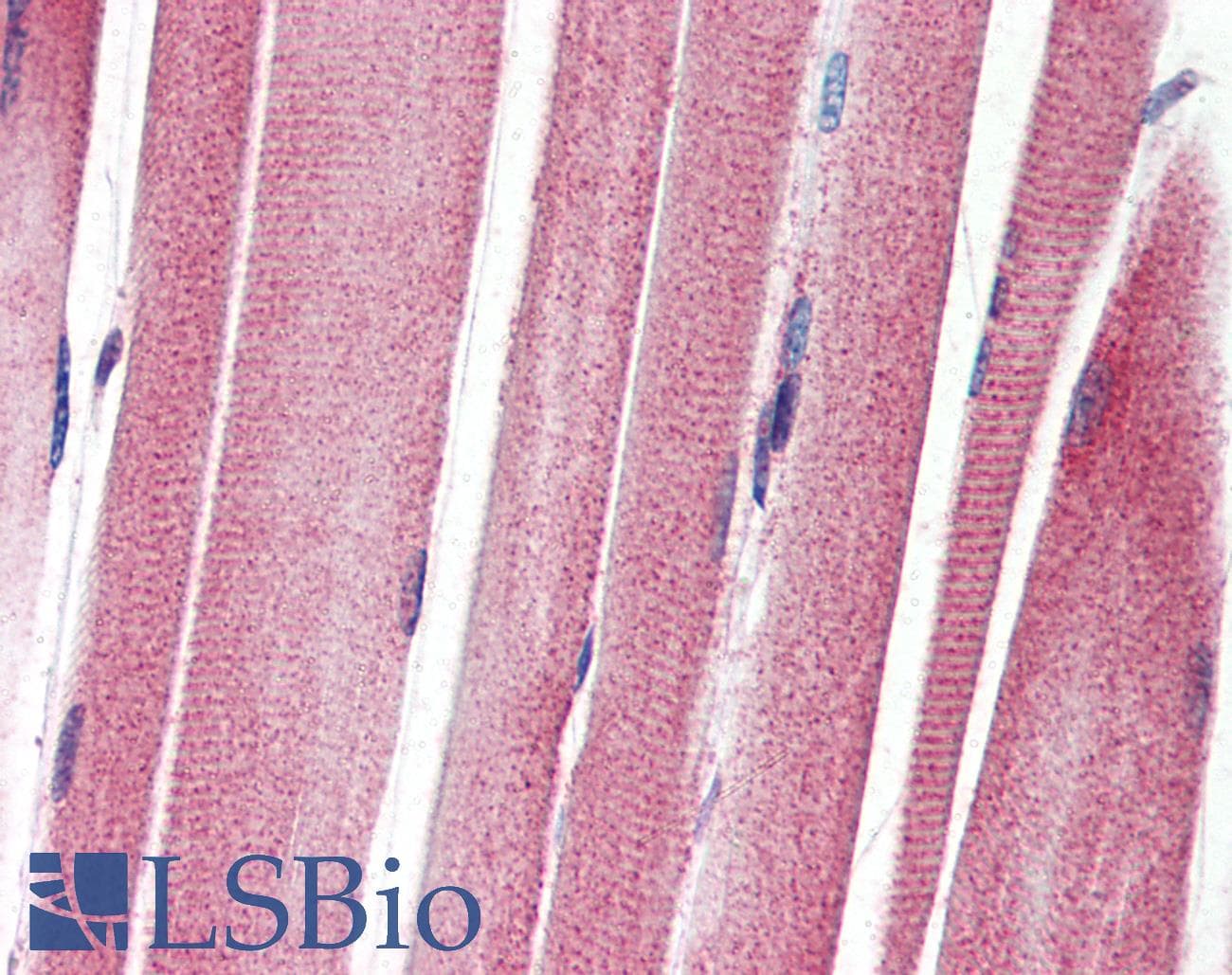 PathPlus™ Monoclonal Mouse anti-Human IGF1R / IGF1 Receptor Antibody (clone JBW902, aa1264-1367, IHC, WB)