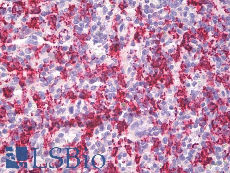 IHC-plus™ HMOX1 / HO-1 Antibody