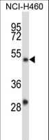 YY2 Antibody (aa224-253)
