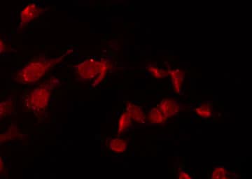 CHF1 / HEY2 Antibody