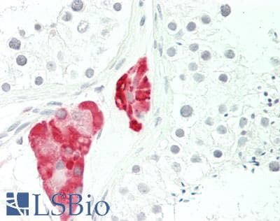 IHC-plus™ CYP17 / CYP17A1 Antibody (aa1-508)