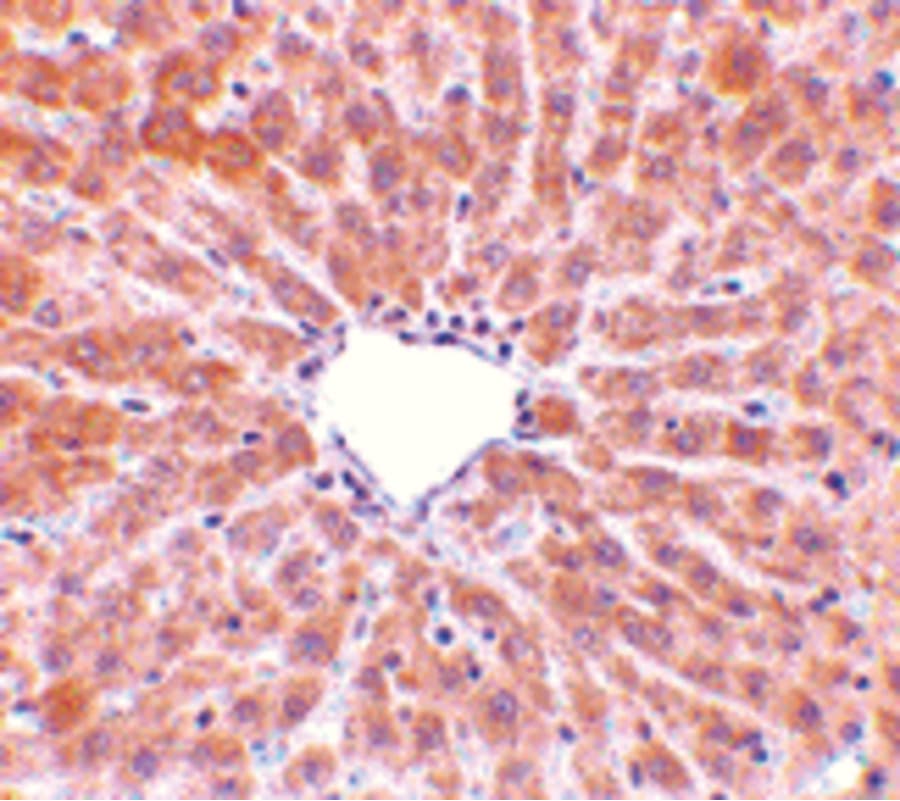 Polyclonal Rabbit anti-Human PLIN3 / M6PRBP1 / TIP47 Antibody (IHC, IF, WB)