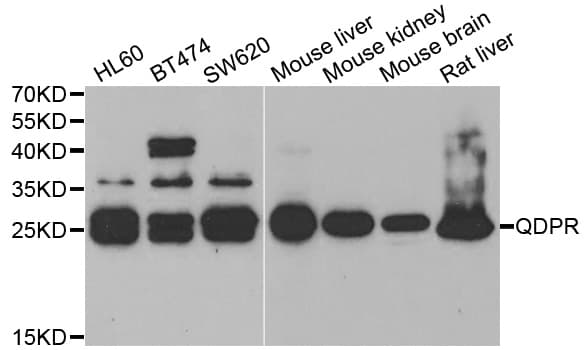 QDPR / DHPR Antibody