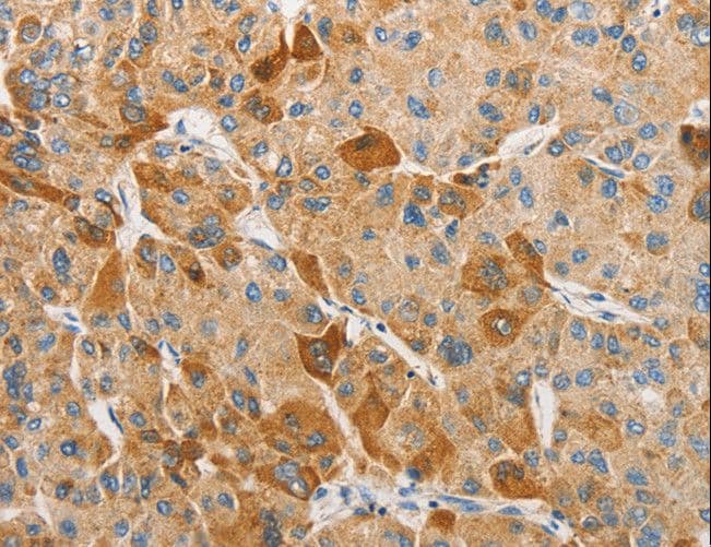 Polyclonal Rabbit anti-Human APOBEC3G / CEM15 Antibody (IHC)