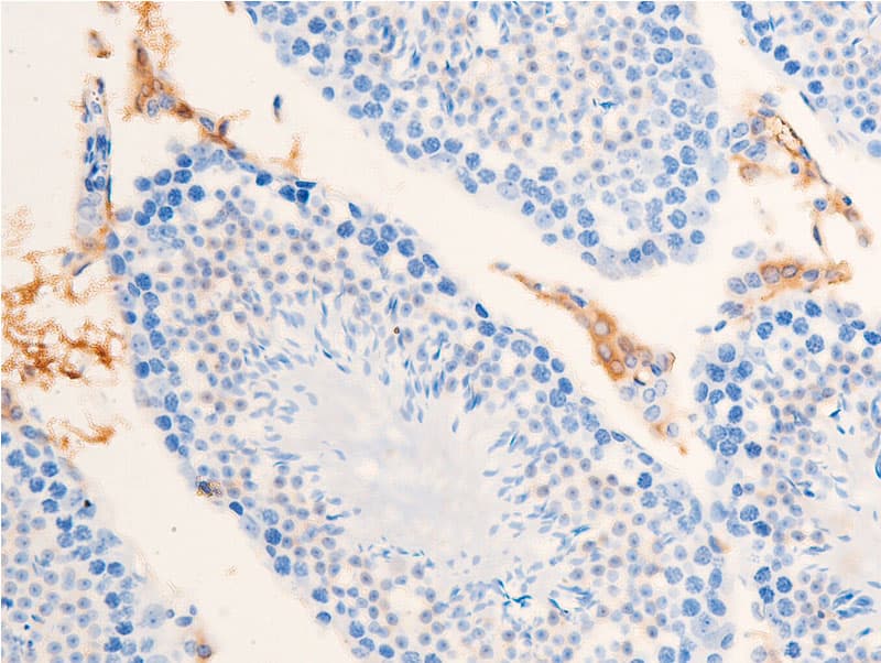 CHEK1 / CHK1 Antibody (phospho-Ser301)
