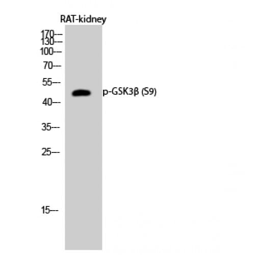 GSK3B / GSK3 Beta Antibody (1-80 aa)