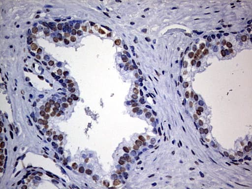 HNRPM / HNRNPM Antibody (aa1-261, clone OTI6H7)