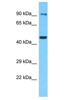 Polyclonal Rabbit anti-Human SCYL2 Antibody (aa655-704, WB)