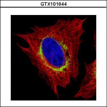 Polyclonal Rabbit anti-Human RRBP1 / hES Antibody (aa1183-1410, IHC, WB)