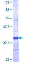 Human SLC2A9 / GLUT9 Protein (Recombinant GST, N-terminus)