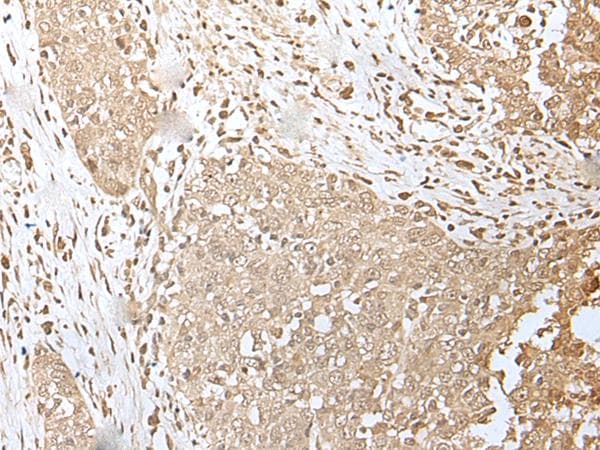 Polyclonal Rabbit anti-Human ZKSCAN3 / ZNF306 Antibody (IHC)