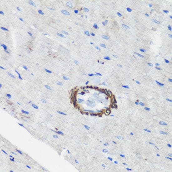 FLNA / Filamin A Antibody