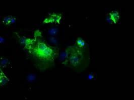 L1CAM Antibody (clone OTI2A6, Carrier-free)