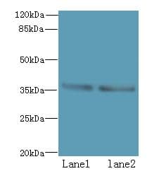 POLR3F Antibody