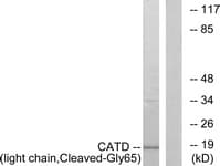CTSD / Cathepsin D Antibody (aa46-95)