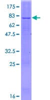 Human Delta-6 Desaturase / FADS2 Protein (Recombinant GST)