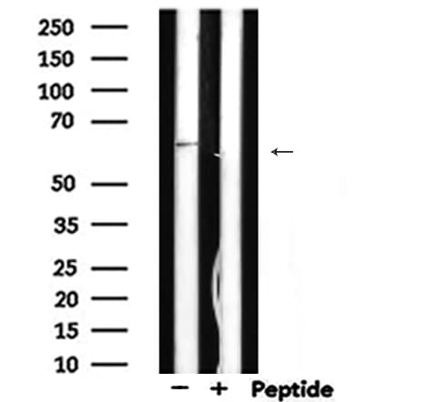 Polyclonal Rabbit anti-Human CYBB / NOX2 / gp91phox Antibody (IHC, WB)