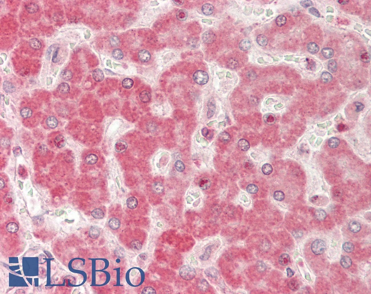 PathPlus™ BMP6 Antibody (aa359-408)