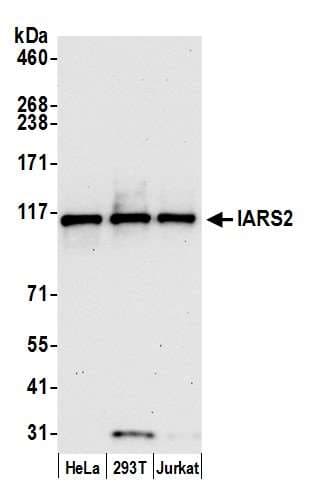 IARS2 Antibody (aa962-1012)