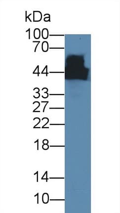 CKM / Creatine Kinase MM Antibody (Biotin)