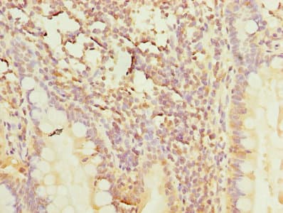 Polyclonal Rabbit anti-Human POLR3A Antibody (aa392-632, IHC)