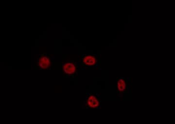 LHX1 Antibody