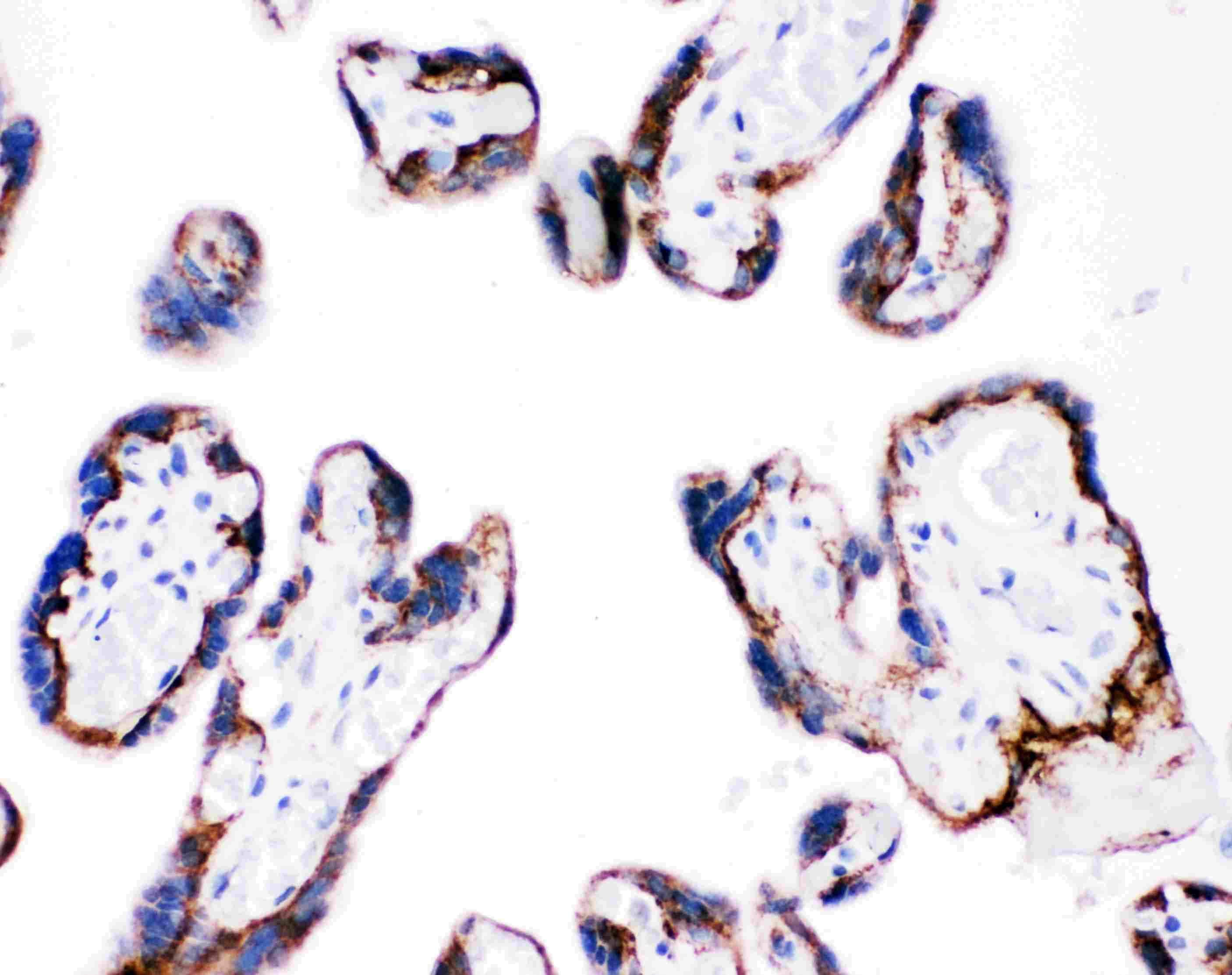 ITGB4 / Integrin Beta 4 Antibody (aa28-266)