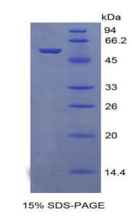 Mouse CXCL1 / GRO Alpha Protein (Recombinant His-MBP)