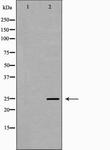 PRG2 / Proteoglycan 2 Antibody