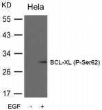 BCL2L1 / BCL-XL Antibody