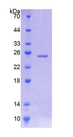Human JPH1 Protein (Recombinant His-T7)