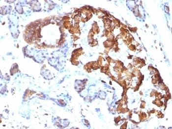 TNF Alpha Antibody (clone TNFA/1172)