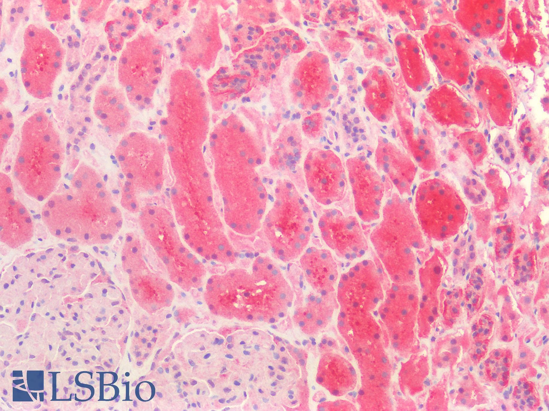 IHC-plus™ HDAC6 Antibody (N-Terminus)