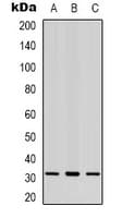 CBR3 Antibody (Internal)