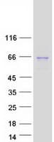 Human FUT8 Protein (Recombinant Myc-DDK (Flag))