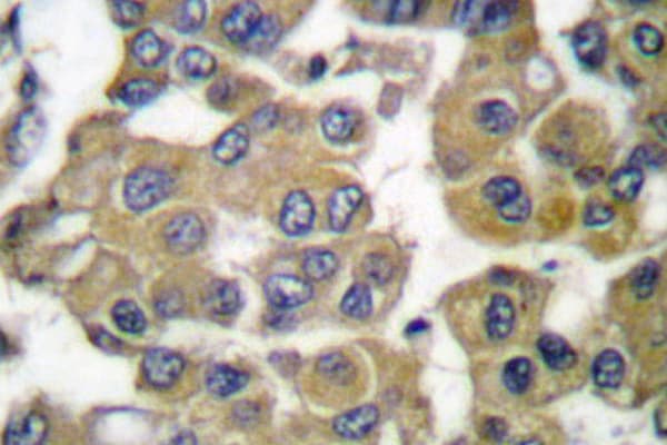 MMP11 Antibody (Gly88)