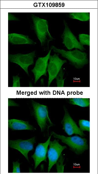 Polyclonal Rabbit anti-Human FGD4 Antibody (aa49-327, IHC, WB)