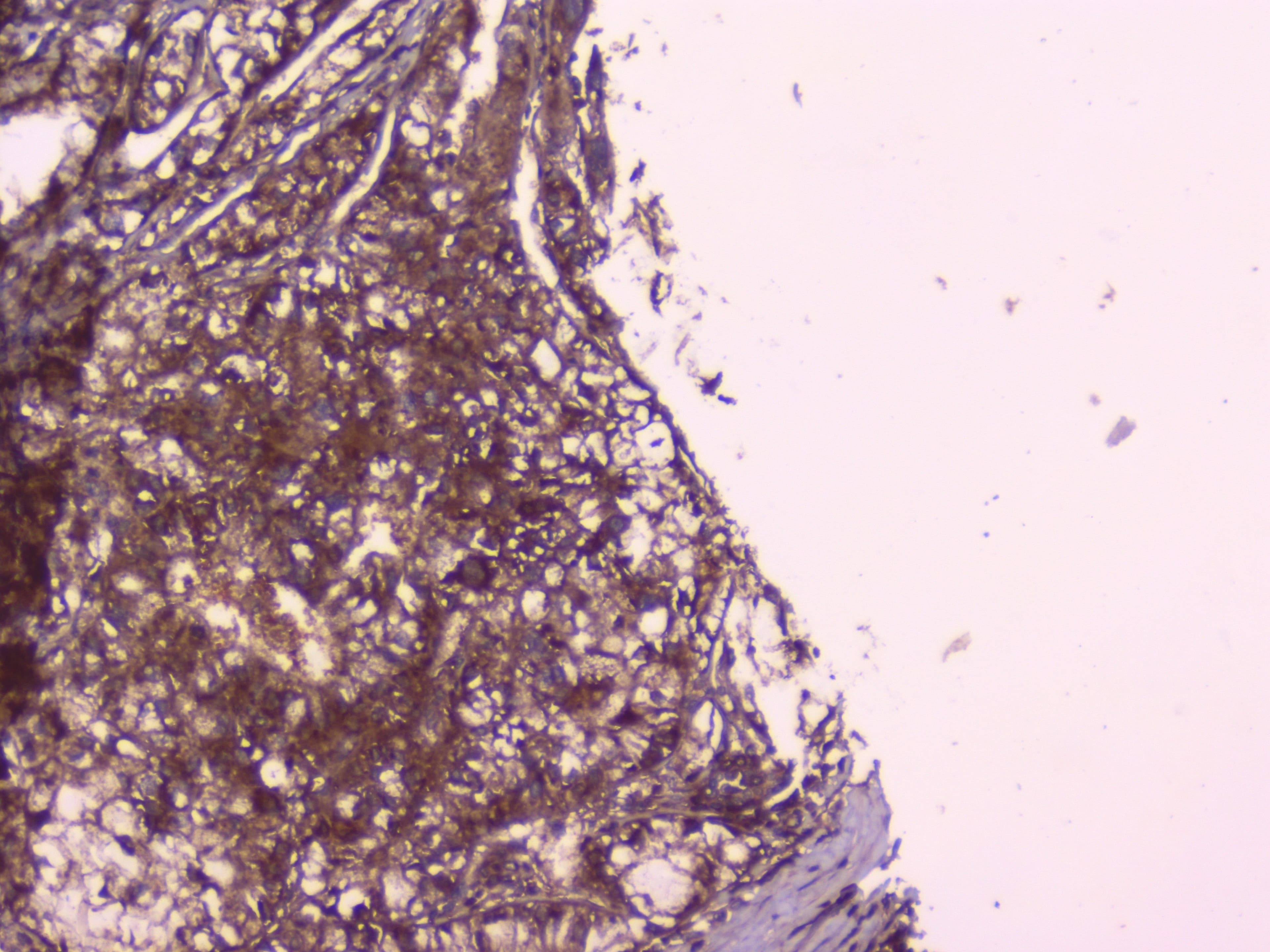 Polyclonal Rabbit anti-Human PEBP1 / RKIP Antibody (WB)