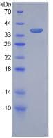 Mouse FLT1 / VEGFR1 Protein (Recombinant His, N-Terminal)