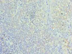 Polyclonal Rabbit anti-Human ASF1A Antibody (aa1-204, IHC, WB)